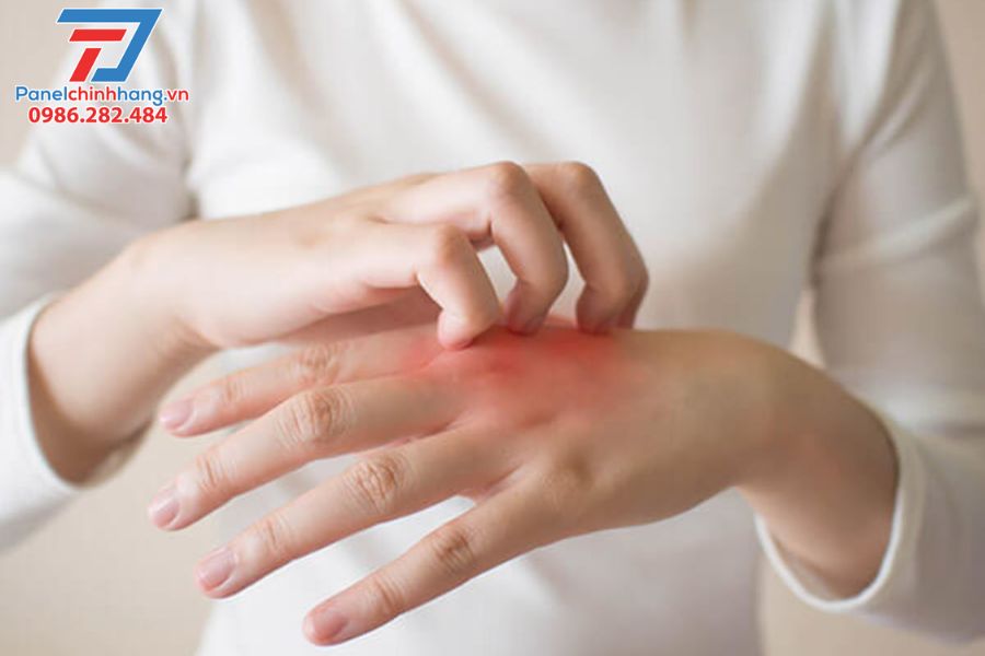 Cách Trị Ngứa Bông Thủy Tinh & Phòng Ngừa Toàn Diện